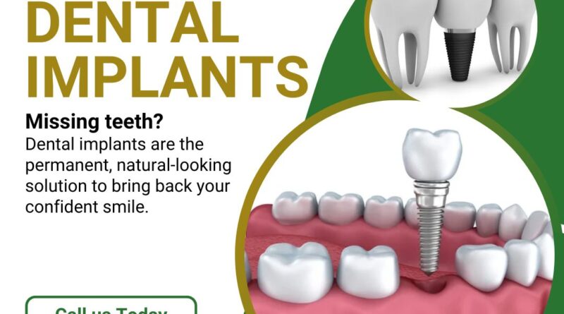 dental implant near me