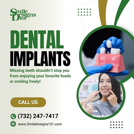 Best dental implants in NJ