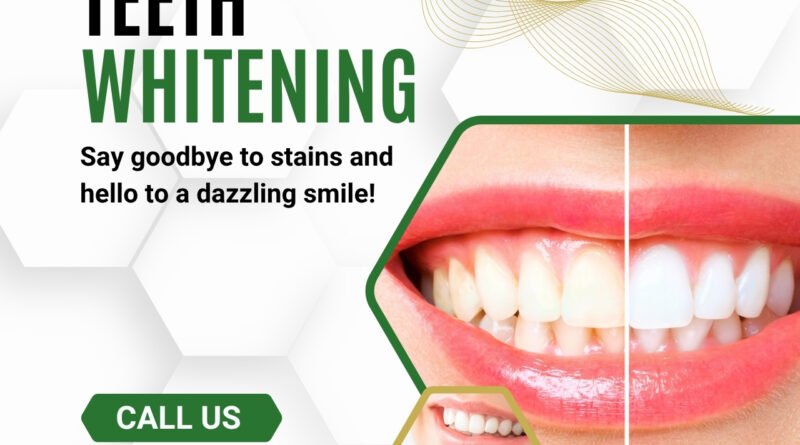 Are There Any Side Effects of BriteSmile Whitening?